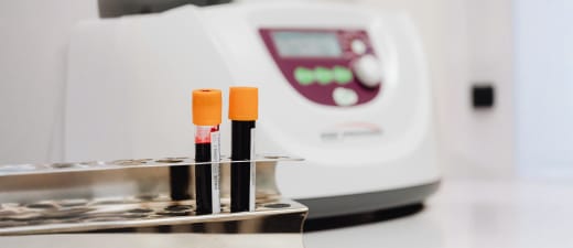 Humane biomonitoring