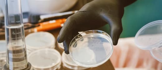 Voedingsbodem waarop bacterie aan het groeien is