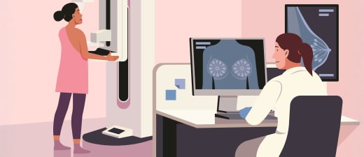Afbeelding preventie terreinwerking: mammografische eenheden